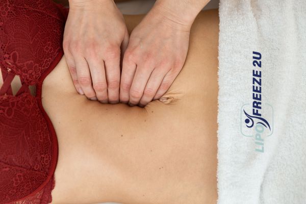 diastasis recti treatment Llanelli