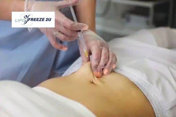 How Does Aqualyx Fat Dissolving Injection Work to Break Down Fat Llanelli?
