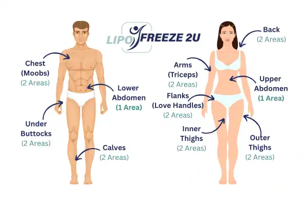Areas you can have fat freezing treatment Llanelli