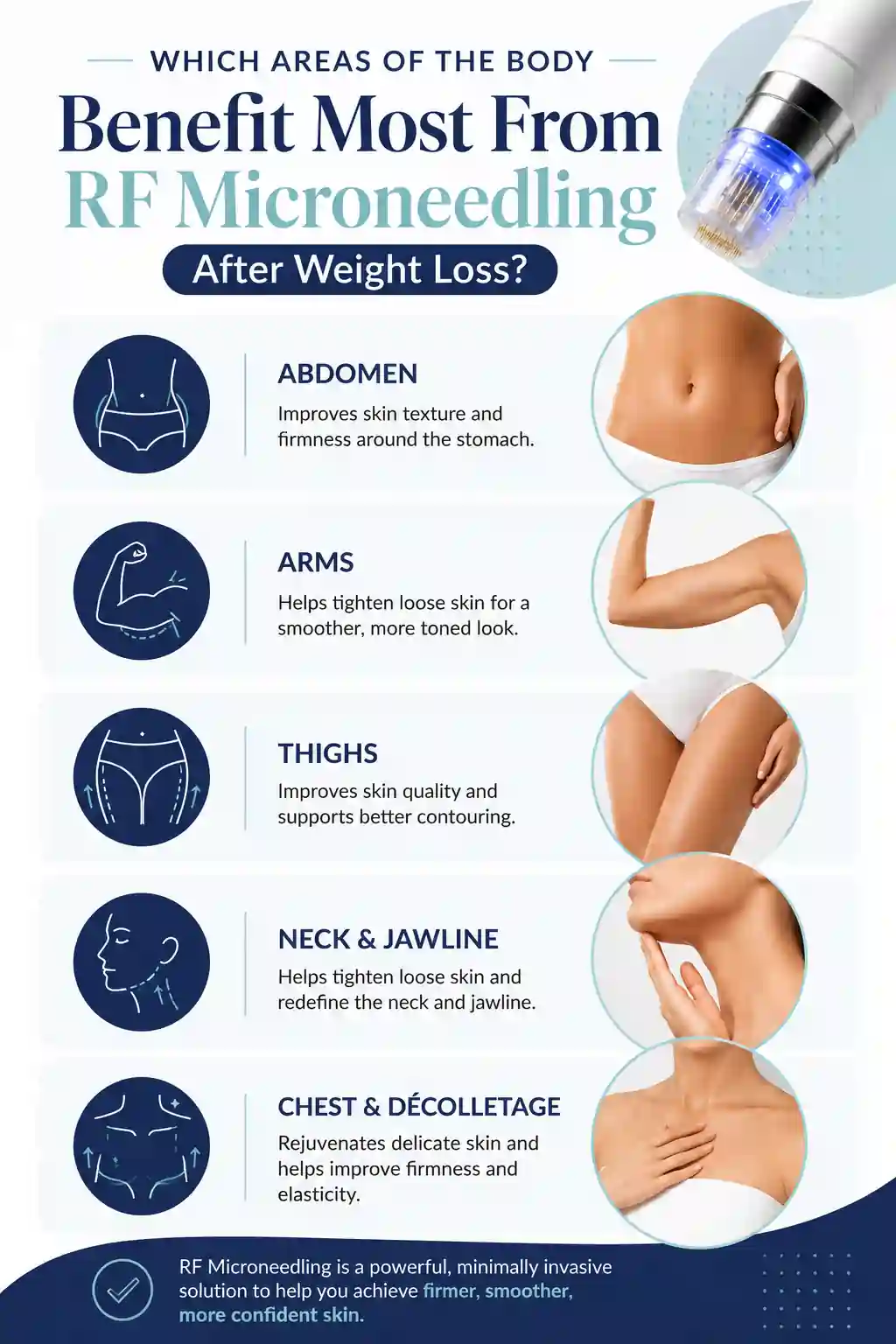 Which Areas of the Body Benefit Most From RF Microneedling After Weight Loss Llanelli